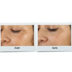 Kiehl'sClearly Corrective Dark Spot - Sérum Correction Anti-Tâches30ml