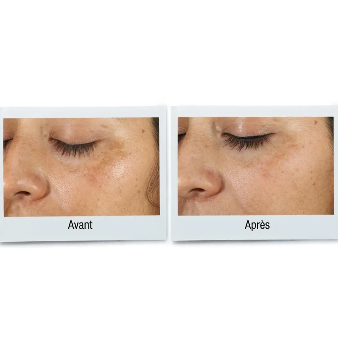 Kiehl'sClearly Corrective Dark Spot - Sérum Correction Anti-Tâches30ml